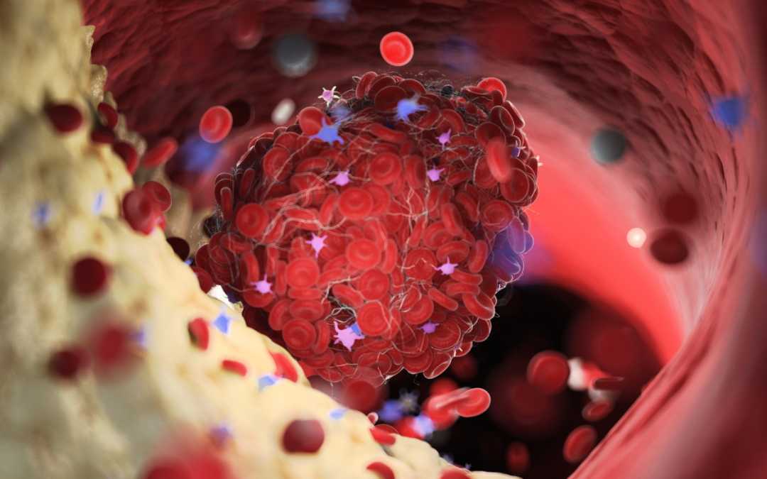 Statine vs omega-3 vegetali: due terapie ipocolesterolemizzanti a confronto