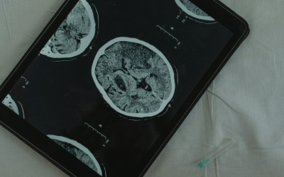 The neuroprotective role of alpha-linolenic acid